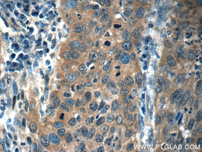 KDELC2 Antibody in Immunohistochemistry (Paraffin) (IHC (P))