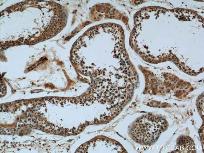 KDELC2 Antibody in Immunohistochemistry (Paraffin) (IHC (P))