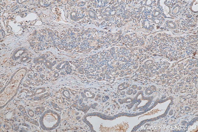 KDELC2 Antibody in Immunohistochemistry (Paraffin) (IHC (P))