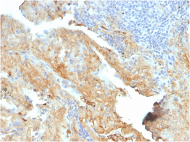 Fibronectin Antibody in Immunohistochemistry (Paraffin) (IHC (P))