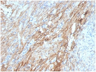 Fibronectin Antibody in Immunohistochemistry (Paraffin) (IHC (P))