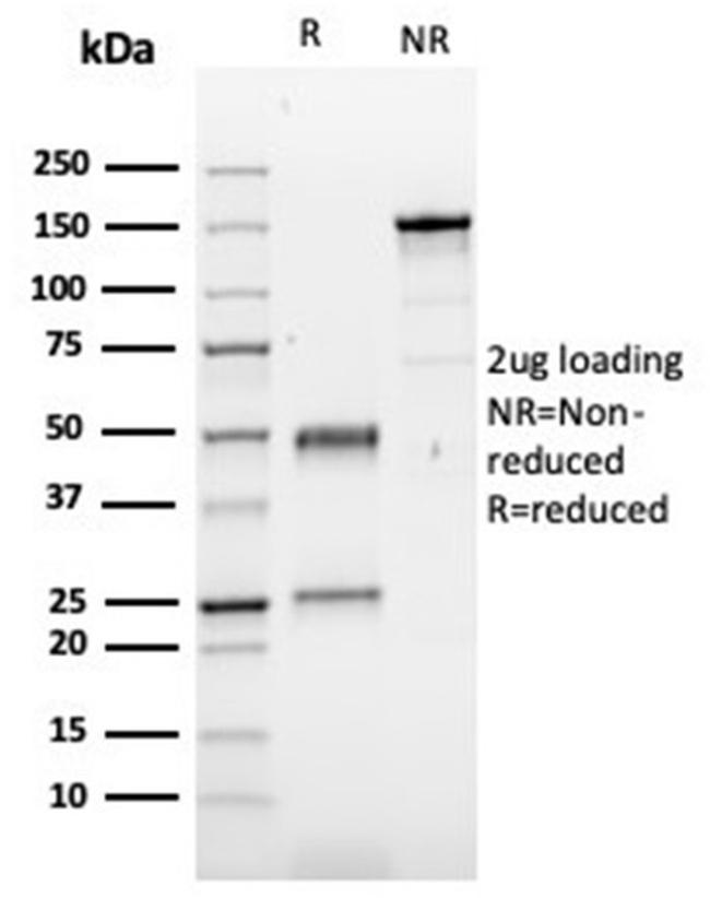 Fibronectin Antibody in SDS-PAGE (SDS-PAGE)