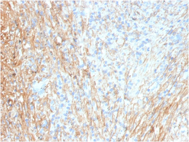 Fibronectin Antibody in Immunohistochemistry (Paraffin) (IHC (P))