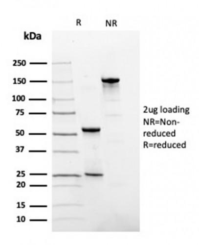 Fibronectin Antibody in SDS-PAGE (SDS-PAGE)