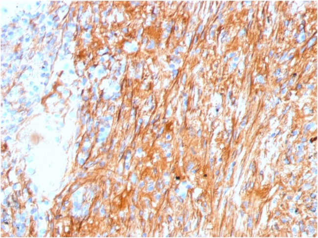 Fibronectin Antibody in Immunohistochemistry (Paraffin) (IHC (P))