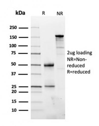 Fibronectin Antibody in SDS-PAGE (SDS-PAGE)