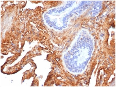 Fibronectin Antibody in Immunohistochemistry (Paraffin) (IHC (P))