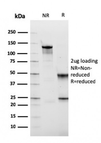 Fibronectin Antibody in SDS-PAGE (SDS-PAGE)