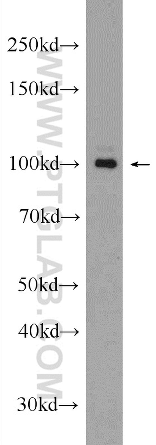 GRIA4 Antibody in Western Blot (WB)