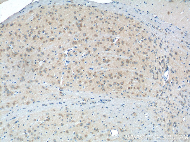 GRIA4 Antibody in Immunohistochemistry (Paraffin) (IHC (P))