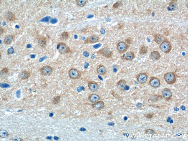 GRIA4 Antibody in Immunohistochemistry (Paraffin) (IHC (P))