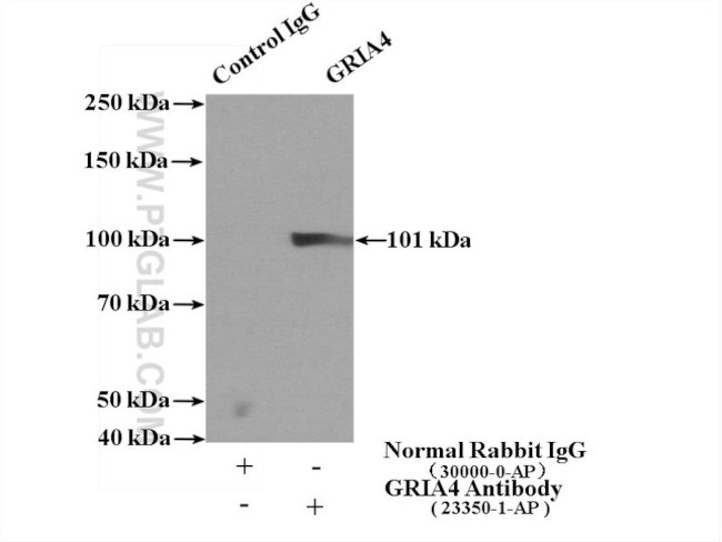 GRIA4 Antibody in Immunoprecipitation (IP)