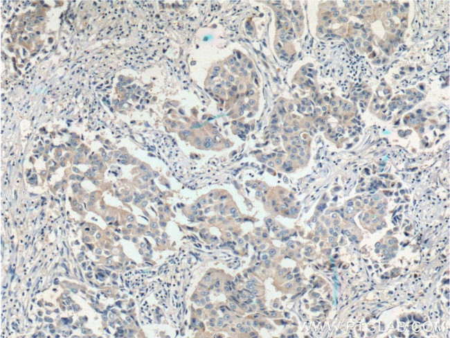 FOLR1 Antibody in Immunohistochemistry (Paraffin) (IHC (P))