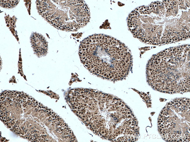 PIAS1 Antibody in Immunohistochemistry (Paraffin) (IHC (P))