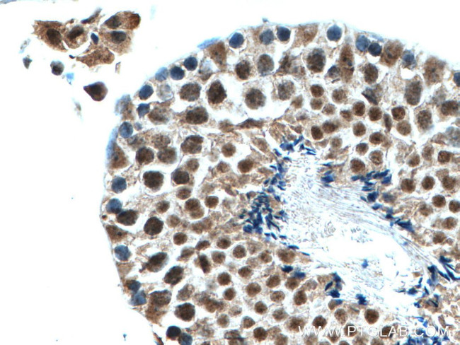 PIAS1 Antibody in Immunohistochemistry (Paraffin) (IHC (P))