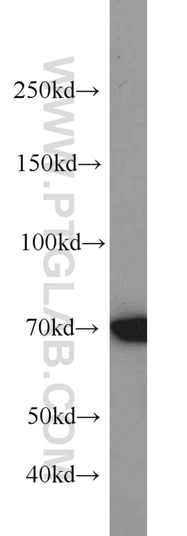 PIAS1 Antibody in Western Blot (WB)