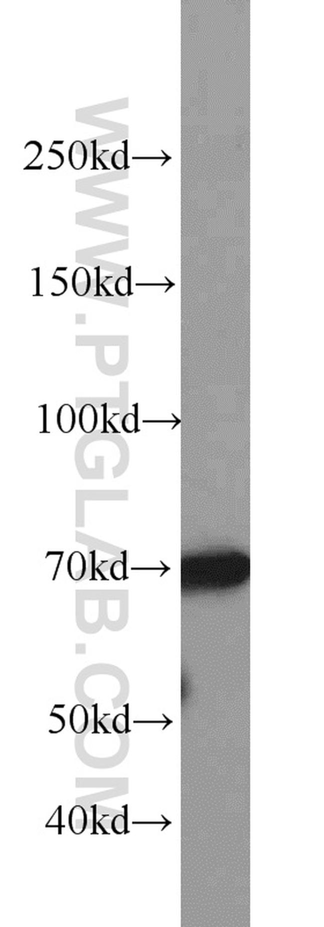 PIAS1 Antibody in Western Blot (WB)