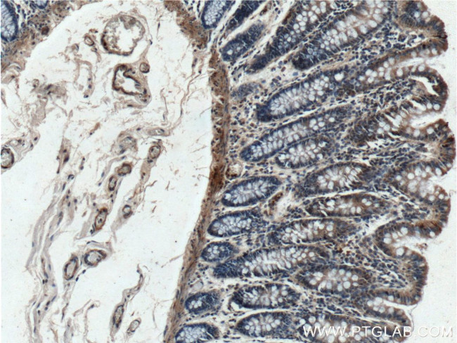 RANKL Antibody in Immunohistochemistry (Paraffin) (IHC (P))