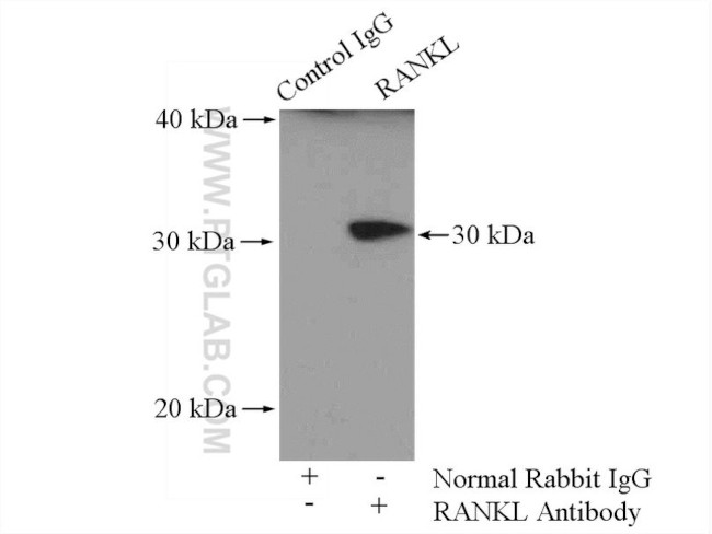 RANKL Antibody in Immunoprecipitation (IP)