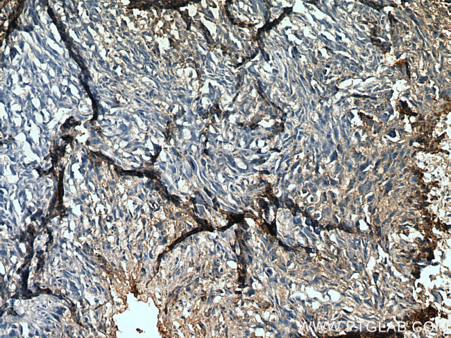 RANKL Antibody in Immunohistochemistry (Paraffin) (IHC (P))