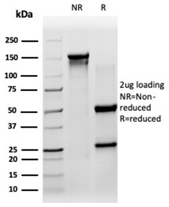 Sirtuin 3 (SIRT3) Antibody in SDS-PAGE (SDS-PAGE)