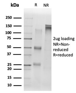 Sirtuin1 (SIRT1) Antibody in SDS-PAGE (SDS-PAGE)