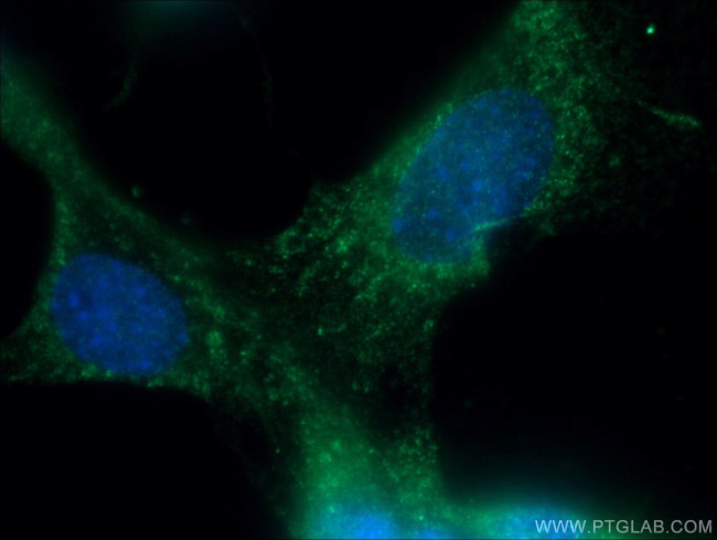 Osteocalcin Antibody in Immunocytochemistry (ICC/IF)