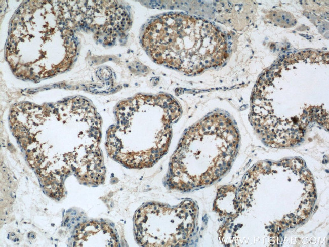 Osteocalcin Antibody in Immunohistochemistry (Paraffin) (IHC (P))