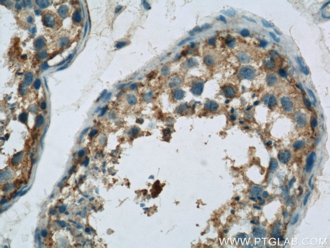 Osteocalcin Antibody in Immunohistochemistry (Paraffin) (IHC (P))