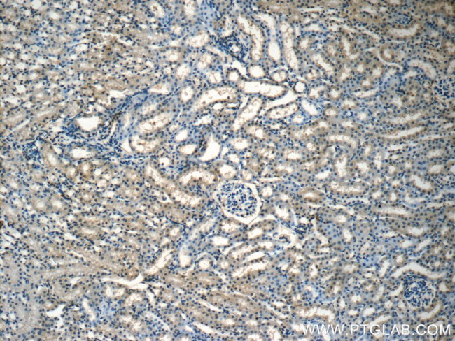 Osteocalcin Antibody in Immunohistochemistry (Paraffin) (IHC (P))