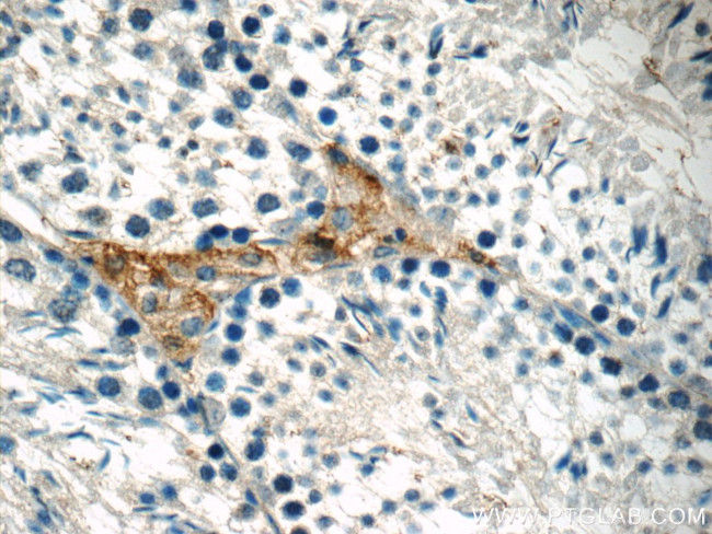 Osteocalcin Antibody in Immunohistochemistry (Paraffin) (IHC (P))