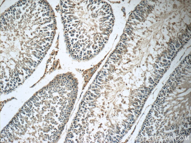 Osteocalcin Antibody in Immunohistochemistry (Paraffin) (IHC (P))