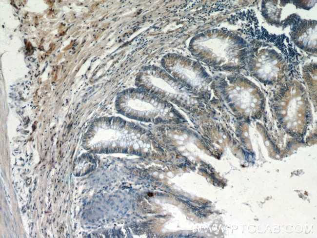 DOCK180 Antibody in Immunohistochemistry (Paraffin) (IHC (P))