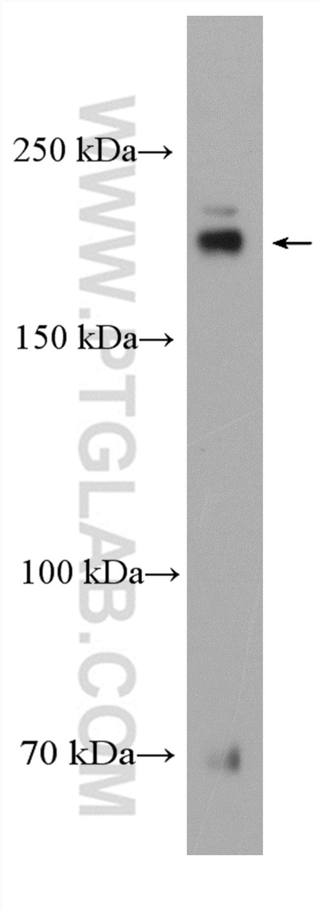 DOCK180 Antibody in Western Blot (WB)