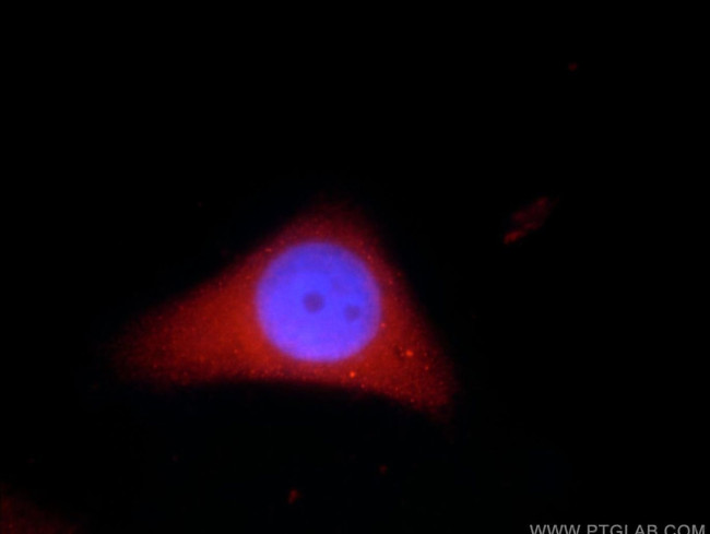 ADH7 Antibody in Immunocytochemistry (ICC/IF)