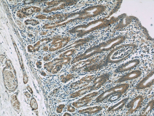 KHDC1 Antibody in Immunohistochemistry (Paraffin) (IHC (P))