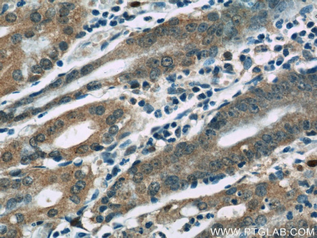 KHDC1 Antibody in Immunohistochemistry (Paraffin) (IHC (P))