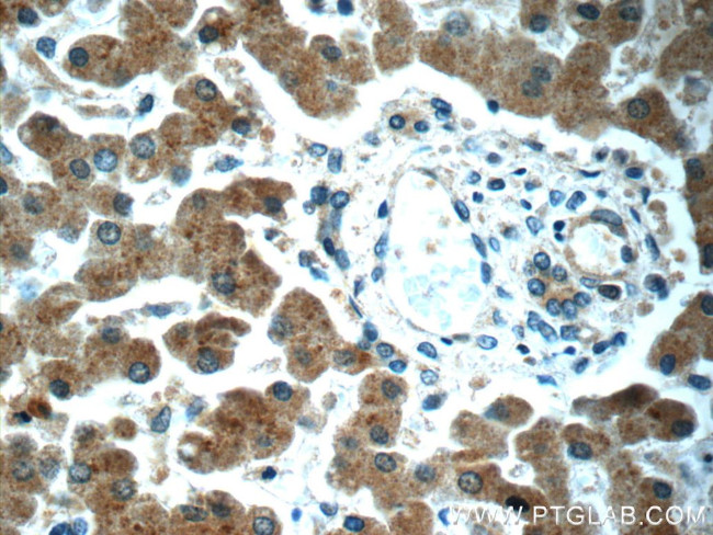 KHDC1 Antibody in Immunohistochemistry (Paraffin) (IHC (P))