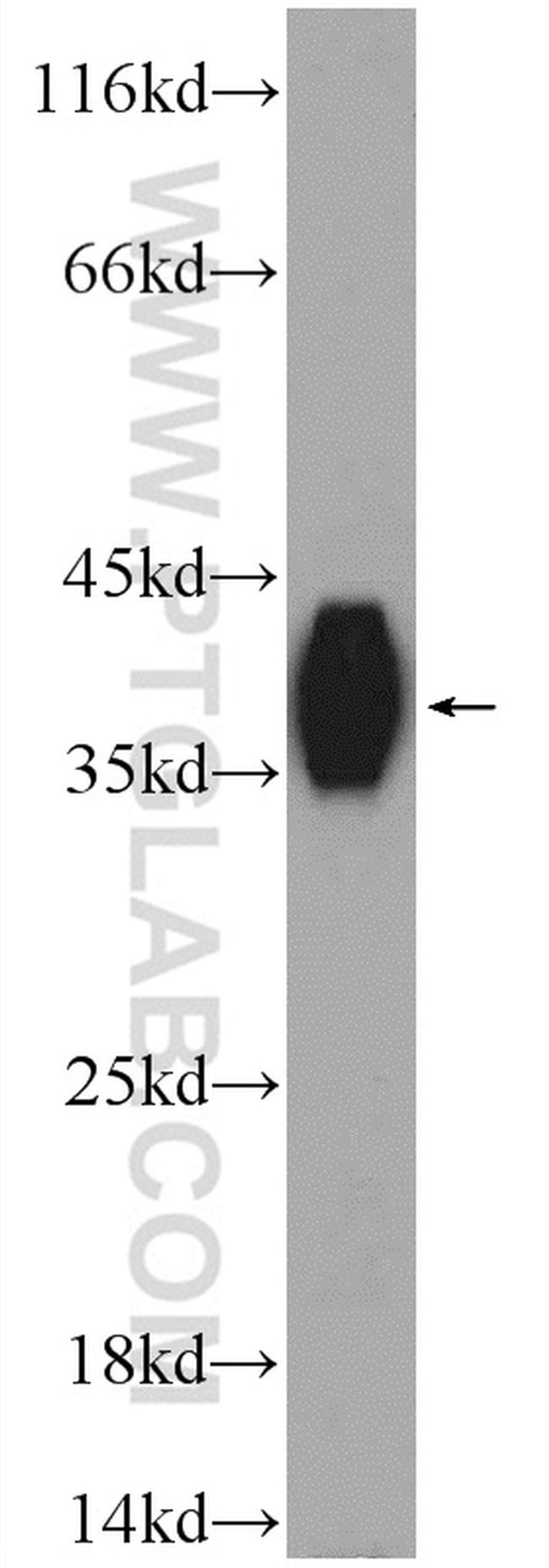 KHDC1 Antibody in Western Blot (WB)