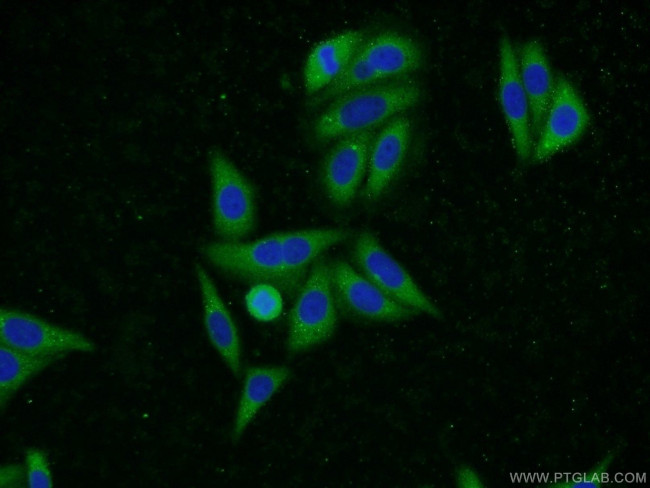 UBQLN2 Antibody in Immunocytochemistry (ICC/IF)