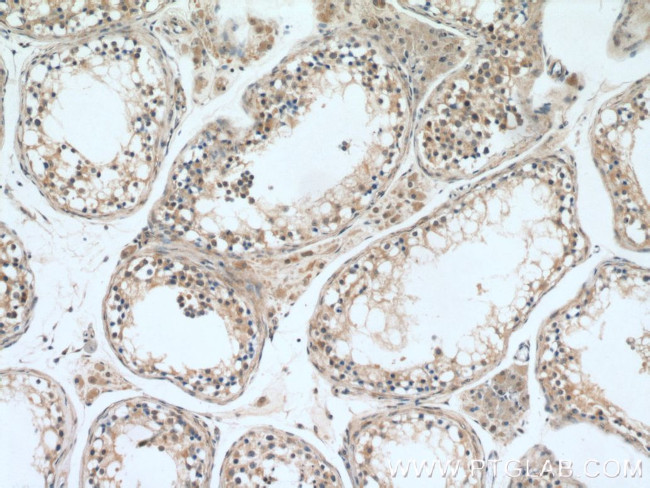 UBQLN2 Antibody in Immunohistochemistry (Paraffin) (IHC (P))