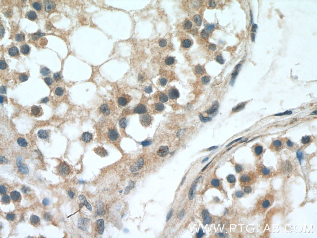 UBQLN2 Antibody in Immunohistochemistry (Paraffin) (IHC (P))