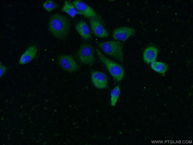 UBQLN2 Antibody in Immunocytochemistry (ICC/IF)