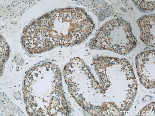 UBQLN2 Antibody in Immunohistochemistry (Paraffin) (IHC (P))