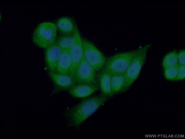 XIAP Antibody in Immunocytochemistry (ICC/IF)