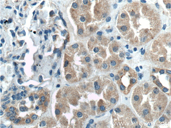 XIAP Antibody in Immunohistochemistry (Paraffin) (IHC (P))