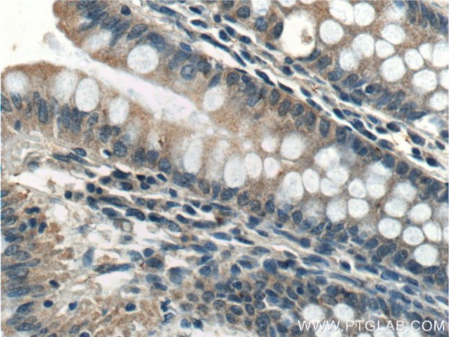 XIAP Antibody in Immunohistochemistry (Paraffin) (IHC (P))