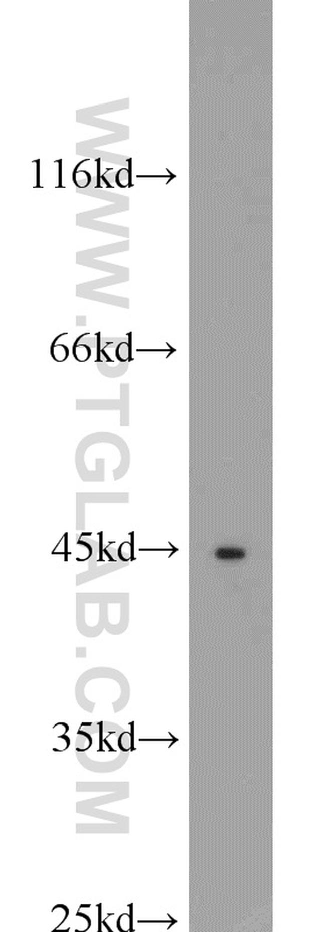 XIAP Antibody in Western Blot (WB)