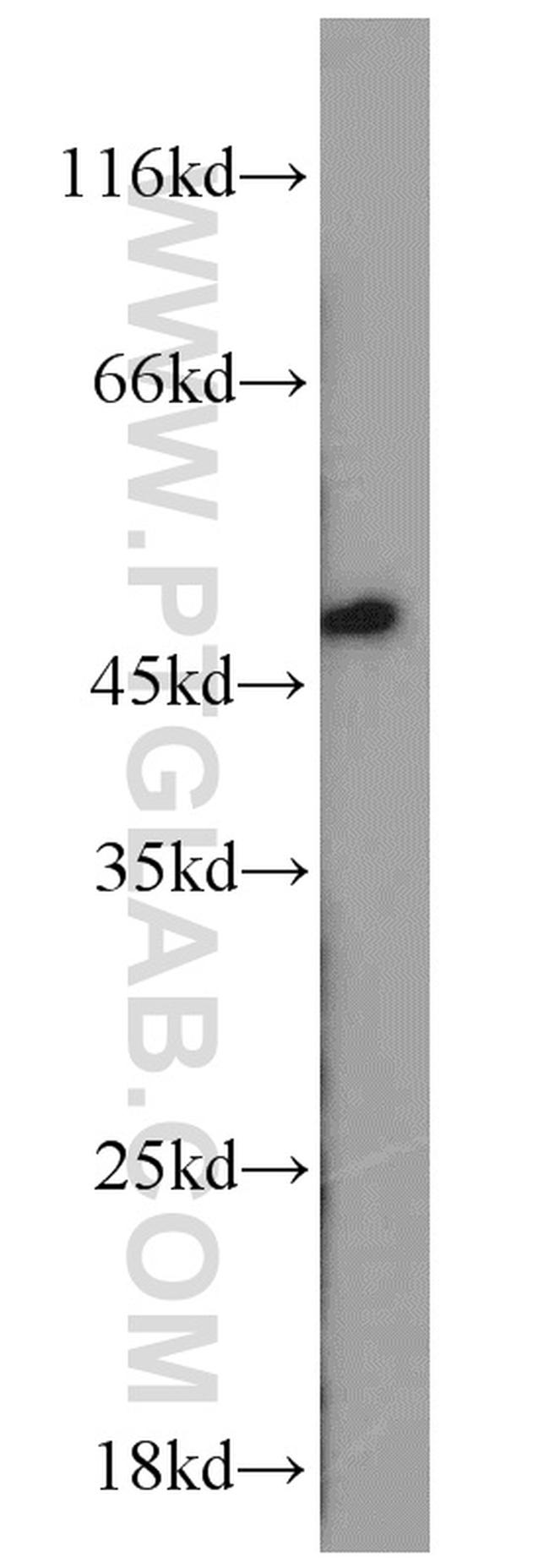 XIAP Antibody in Western Blot (WB)