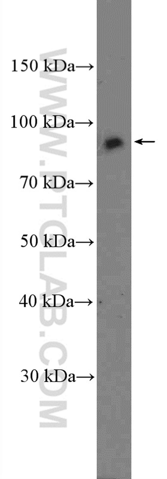 TNFAIP3 Antibody in Western Blot (WB)